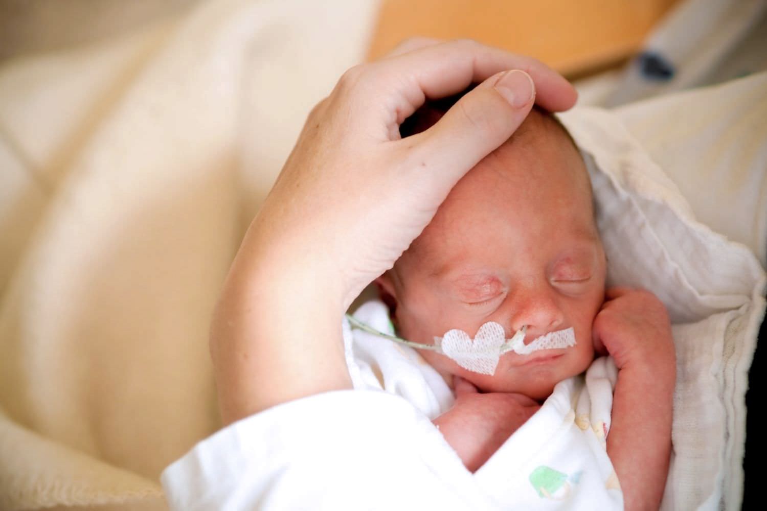 Bild zeigt: Frühgeborenes mit Sauerstoffbrille in den Händen der Mutter