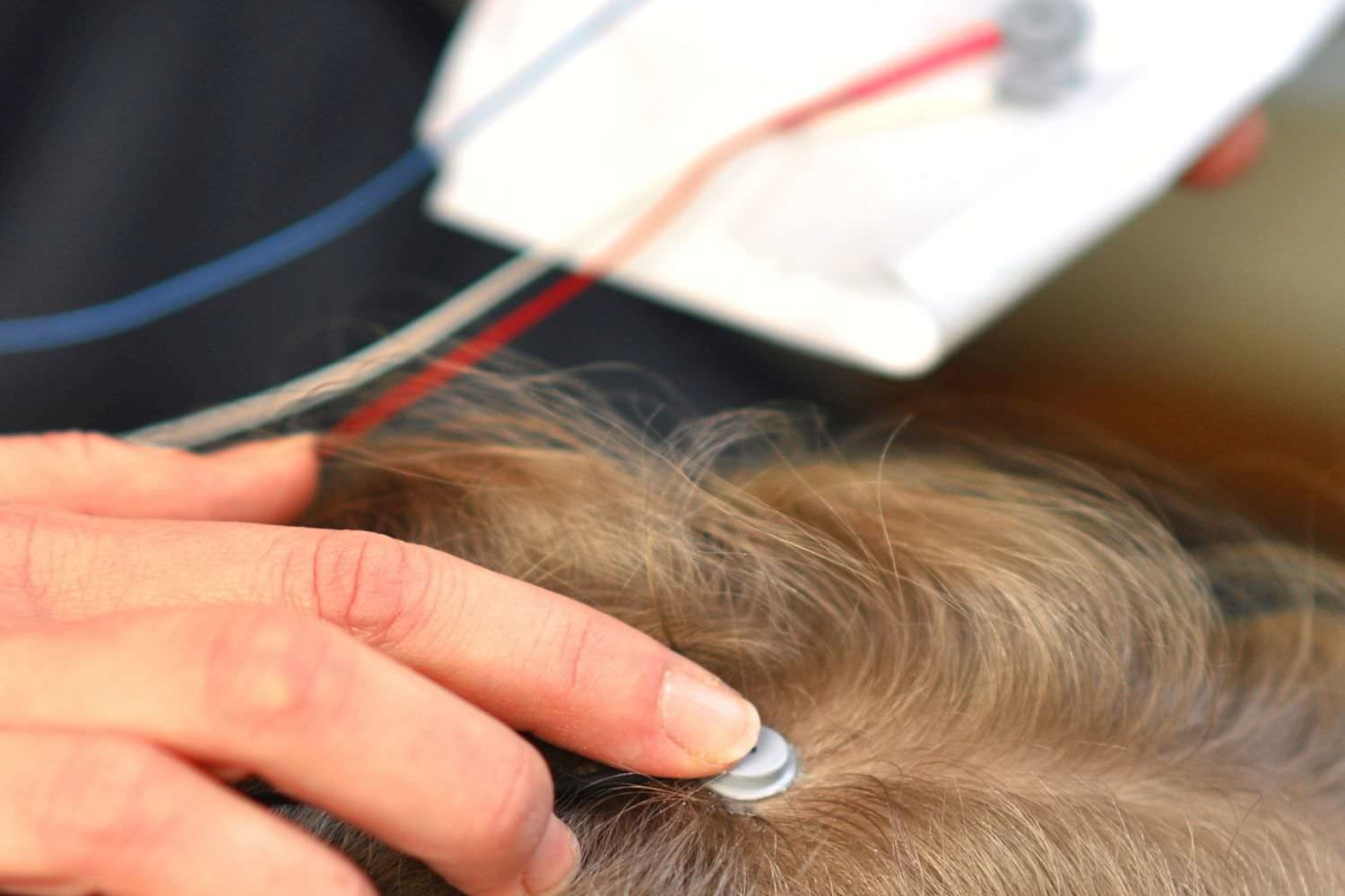 Bild zeigt: Eine Elektrode wird zur Messung der Gehirnströme auf der Kopfhaut eines Kindes platziert